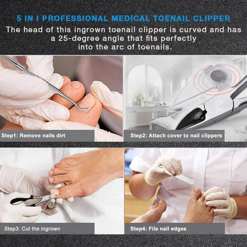 （50% OFF ）Medical-grade Nail Clippers